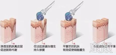 https://img.miyanlife.com/mnt/timg/180608/11045C131-10.jpg