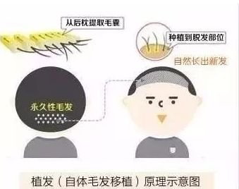 https://img.miyanlife.com/mnt/timg/180608/11213M129-0.jpg