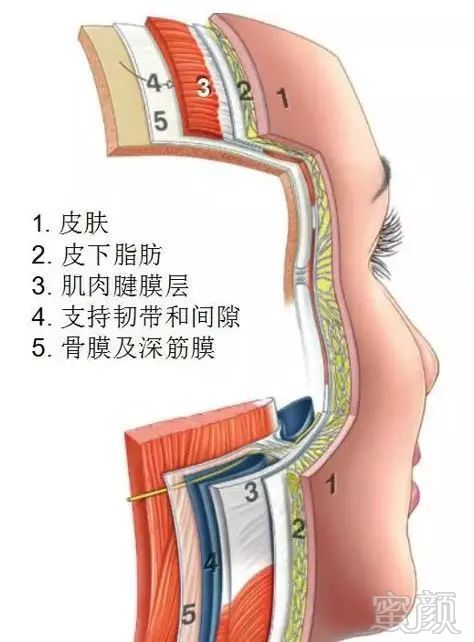 案例图片