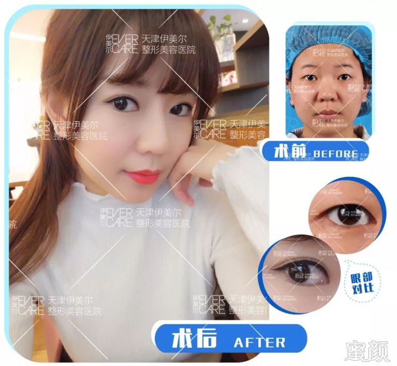 https://img.miyanlife.com/mnt/timg/180608/1134023212-7.jpg