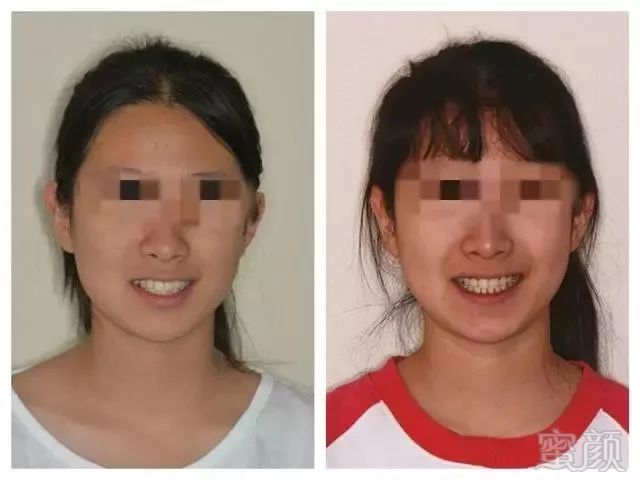 https://img.miyanlife.com/mnt/timg/180608/1309346053-1.jpg