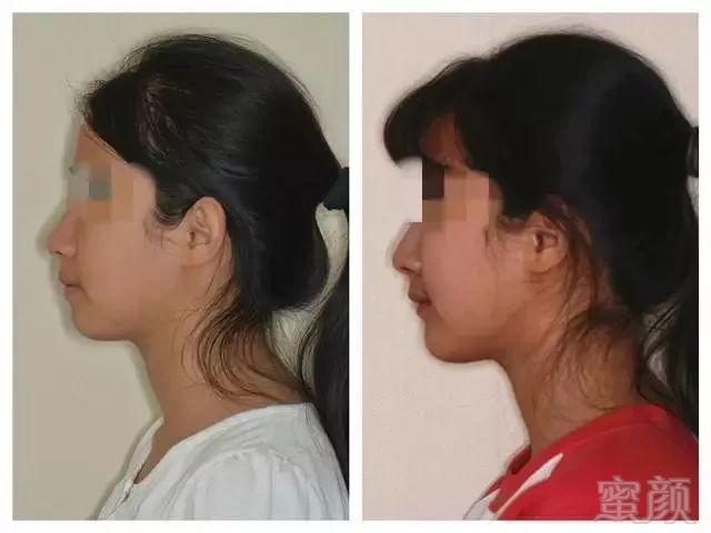 https://img.miyanlife.com/mnt/timg/180608/1309353407-2.jpg