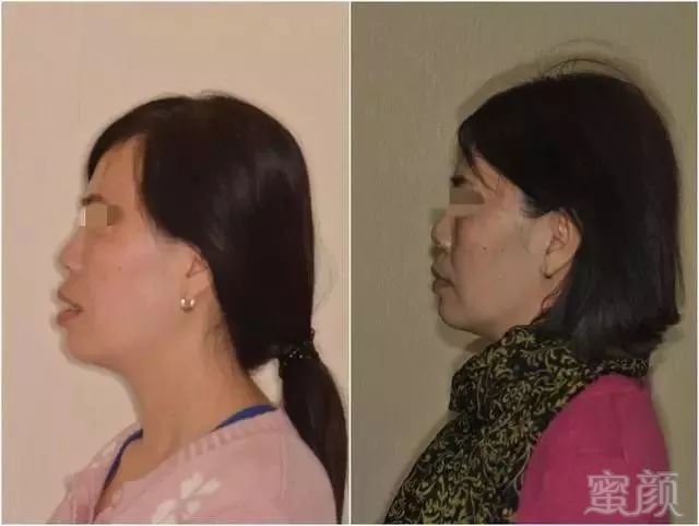 https://img.miyanlife.com/mnt/timg/180608/1309353533-5.jpg