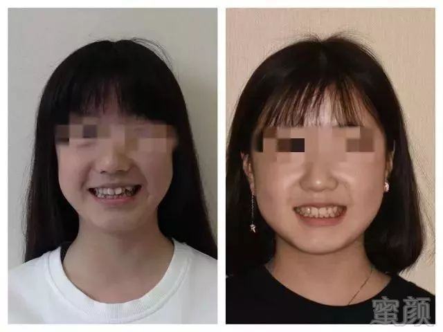 https://img.miyanlife.com/mnt/timg/180608/1309355104-4.jpg