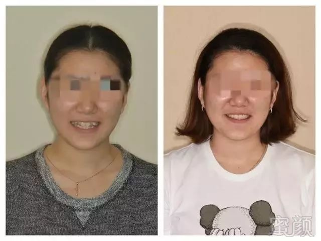 https://img.miyanlife.com/mnt/timg/180608/1309355416-3.jpg