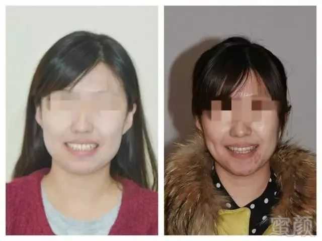 https://img.miyanlife.com/mnt/timg/180608/1309362934-8.jpg