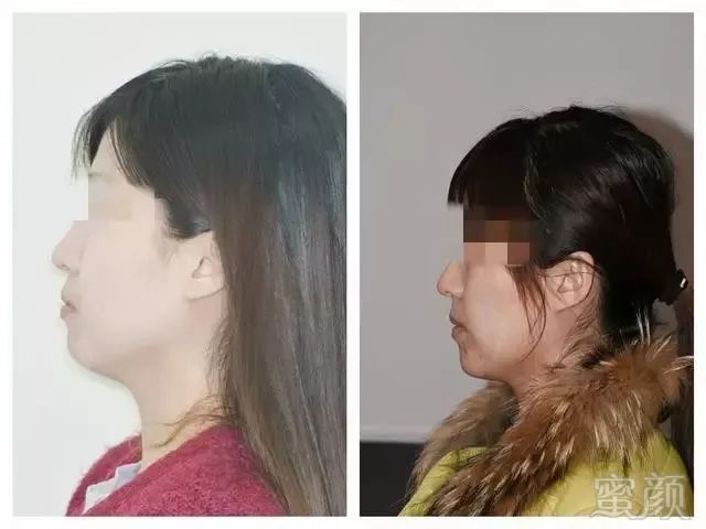 https://img.miyanlife.com/mnt/timg/180608/13093A114-9.jpg