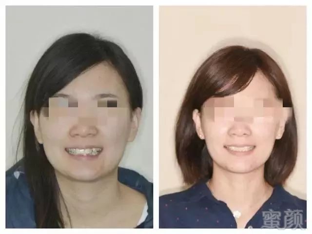 https://img.miyanlife.com/mnt/timg/180608/13093A1I-6.jpg