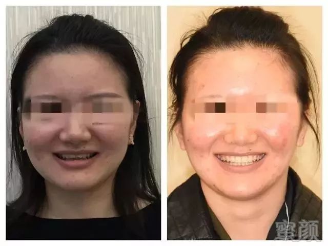 https://img.miyanlife.com/mnt/timg/180608/13093KE7-10.jpg