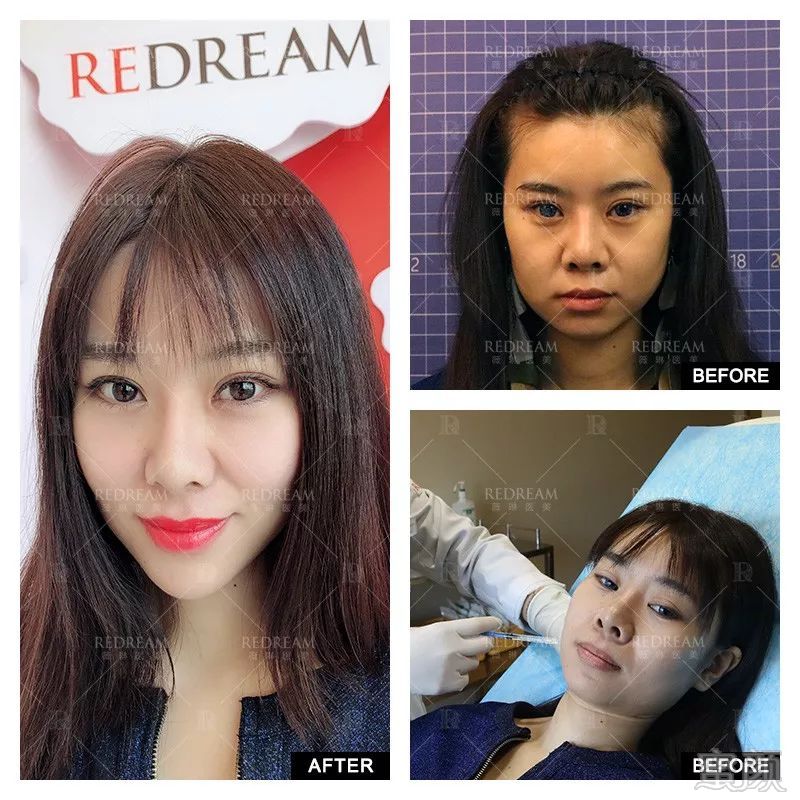 https://img.miyanlife.com/mnt/timg/180608/131035C40-0.jpg