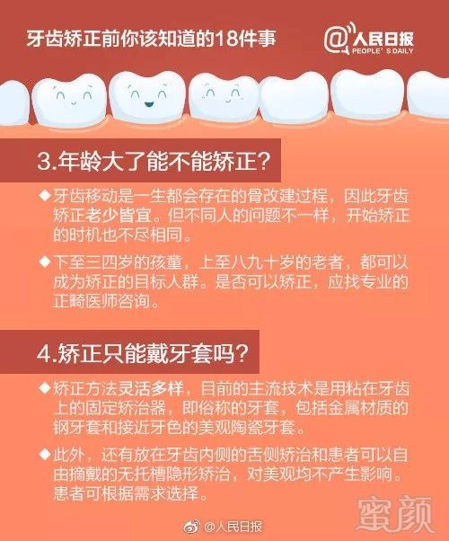 https://img.miyanlife.com/mnt/timg/180609/12411K154-1.jpg