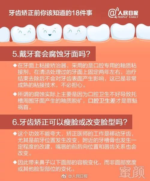 https://img.miyanlife.com/mnt/timg/180609/12411K9D-2.jpg