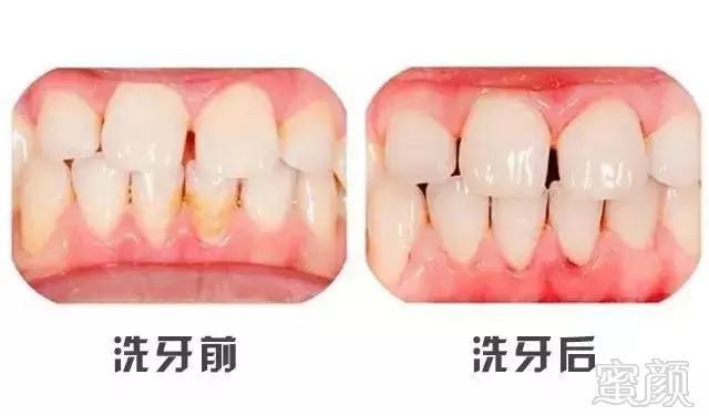 https://img.miyanlife.com/mnt/timg/180609/125I92c2-3.jpg