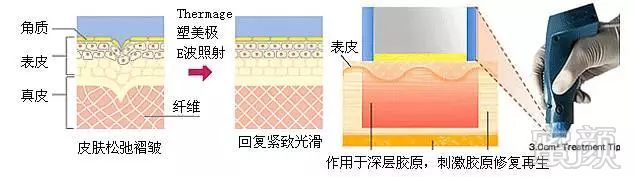 案例图片