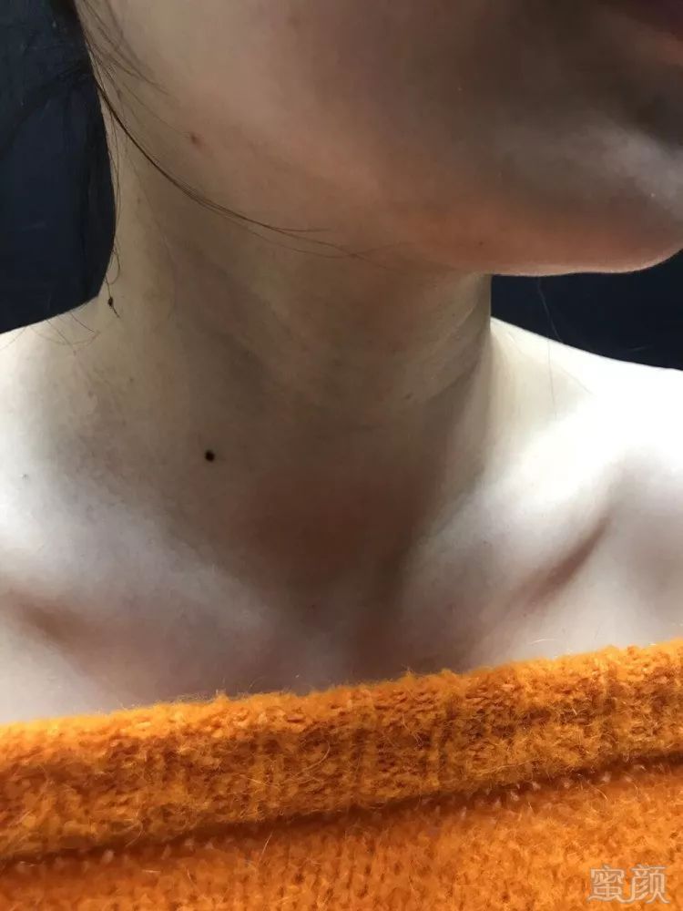 https://img.miyanlife.com/mnt/timg/180609/1343445X6-0.jpg
