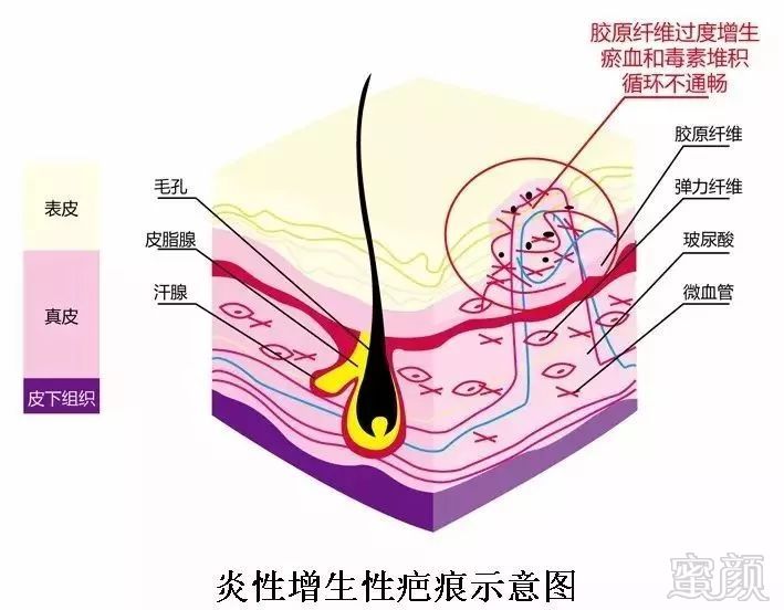 案例图片