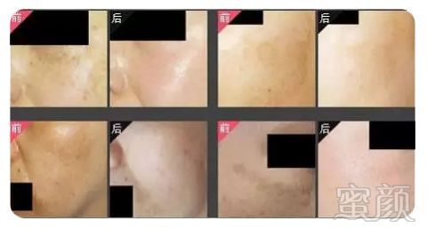 https://img.miyanlife.com/mnt/timg/180610/104AC952-4.jpg