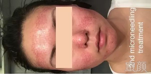 https://img.miyanlife.com/mnt/timg/180610/104FJ531-8.jpg