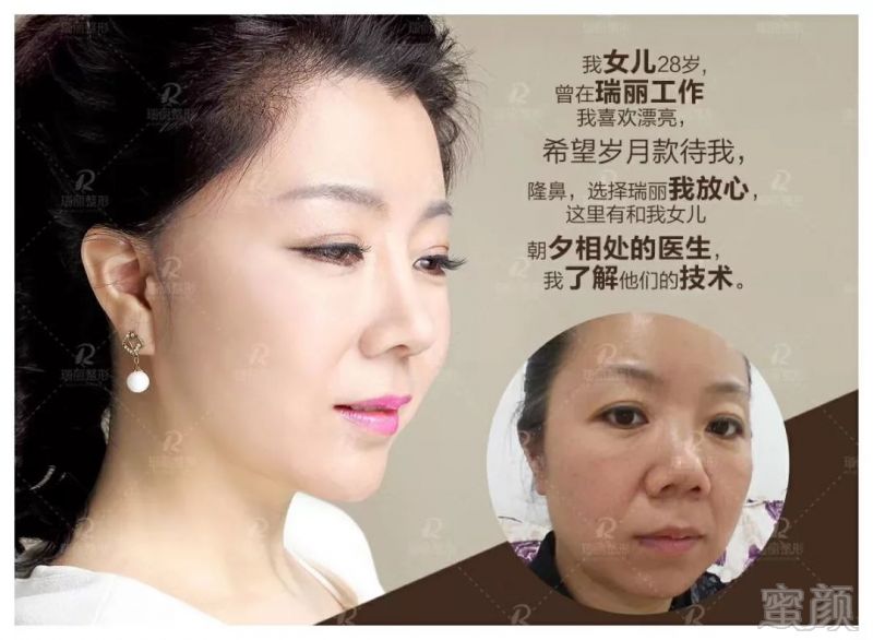 案例图片