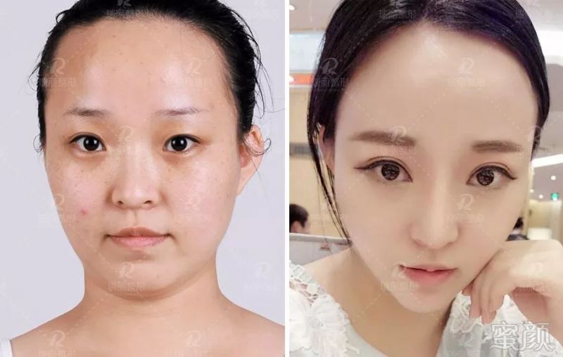 案例图片