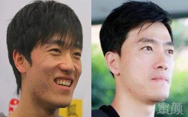 案例图片
