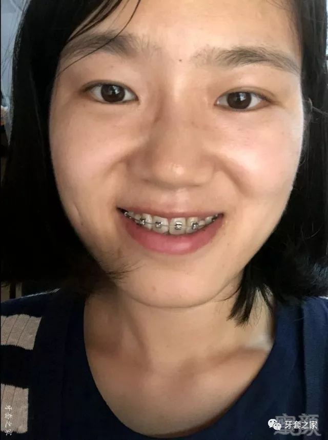 https://img.miyanlife.com/mnt/timg/180610/1115512K9-2.jpg