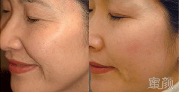 https://img.miyanlife.com/mnt/timg/180610/111R94161-2.jpg