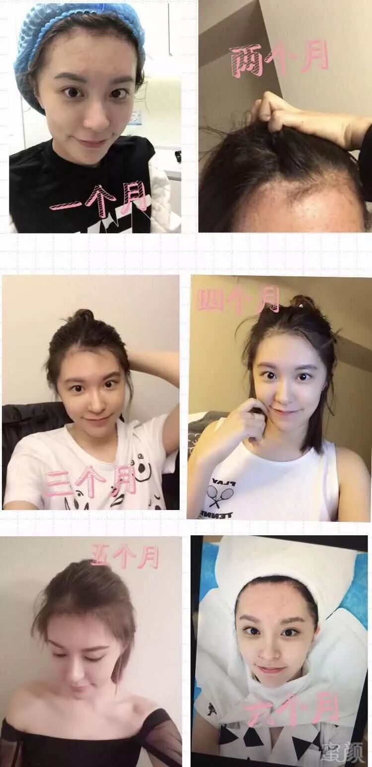 https://img.miyanlife.com/mnt/timg/180610/11240M621-12.jpg