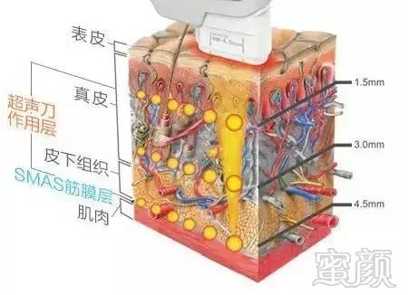 案例图片