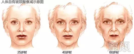 https://img.miyanlife.com/mnt/timg/180611/1100423143-0.jpg