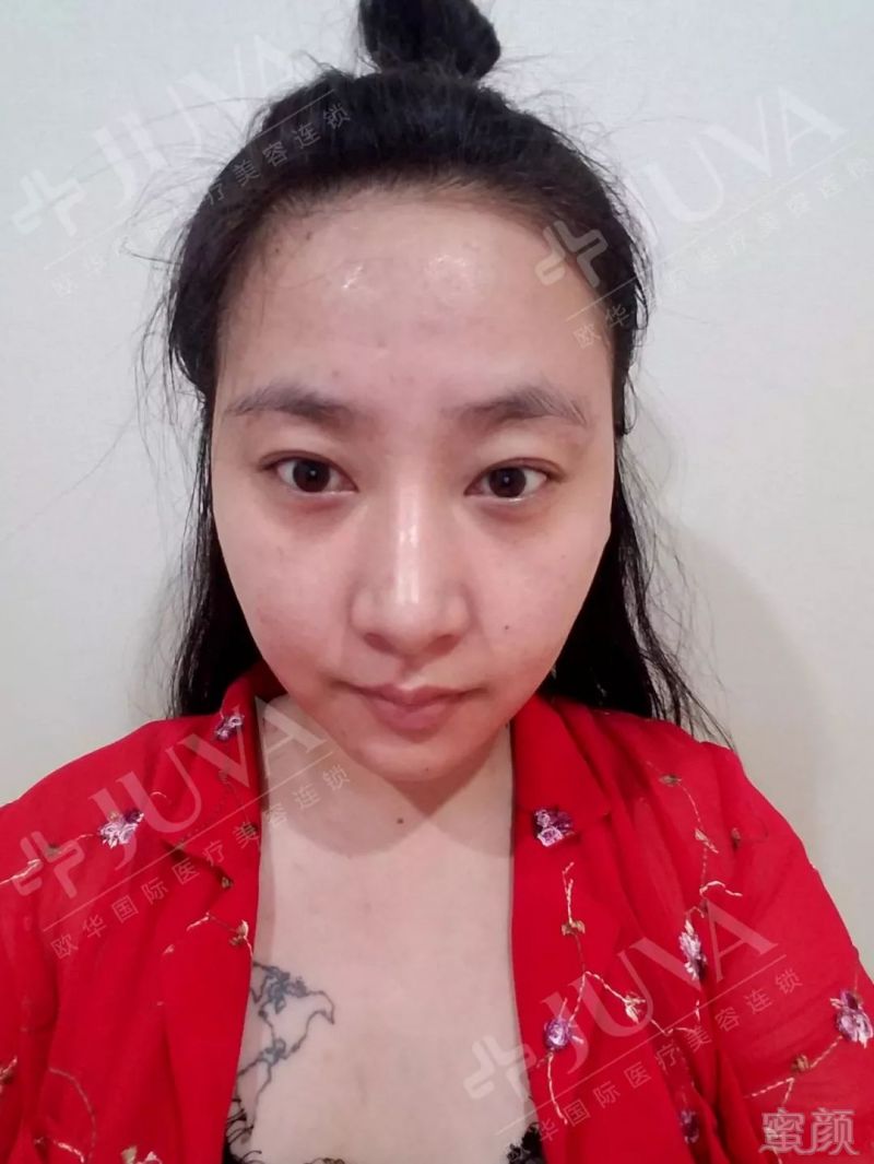https://img.miyanlife.com/mnt/timg/180611/1106304040-2.jpg