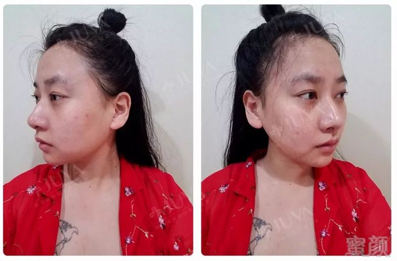 https://img.miyanlife.com/mnt/timg/180611/11063125P-3.jpg