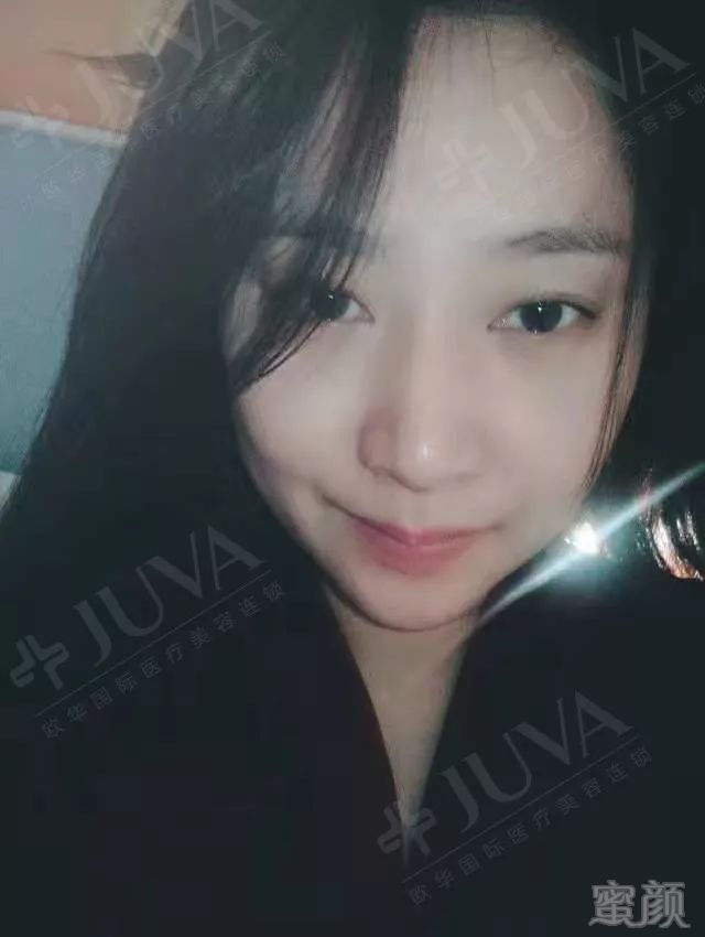 https://img.miyanlife.com/mnt/timg/180611/1106342544-7.jpg