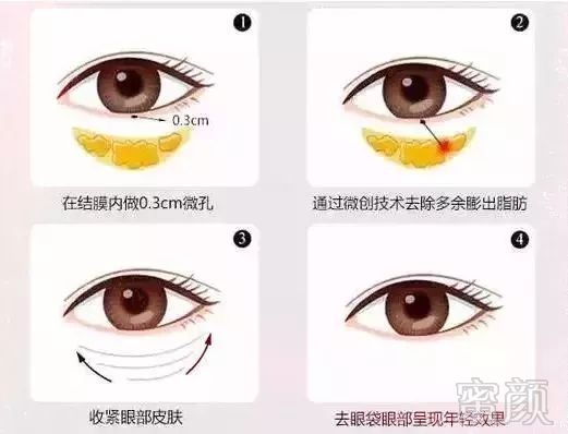 https://img.miyanlife.com/mnt/timg/180611/110K16495-7.jpg