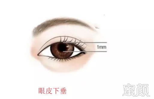 案例图片