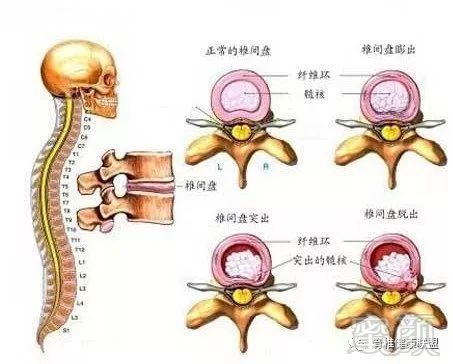 案例图片