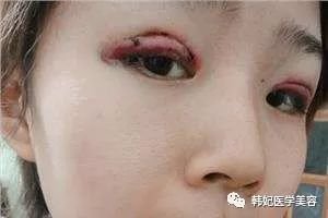 https://img.miyanlife.com/mnt/timg/180611/1134235547-5.jpg
