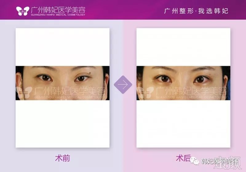 https://img.miyanlife.com/mnt/timg/180611/1134241461-7.jpg