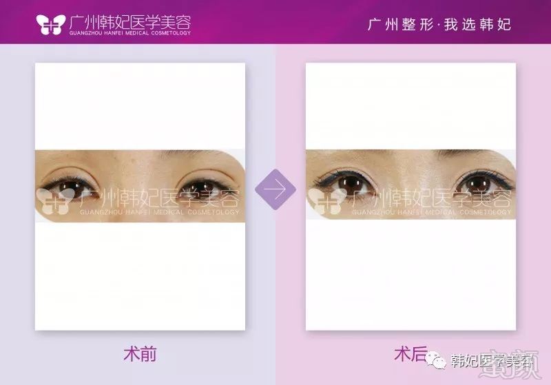 https://img.miyanlife.com/mnt/timg/180611/11342C229-8.jpg