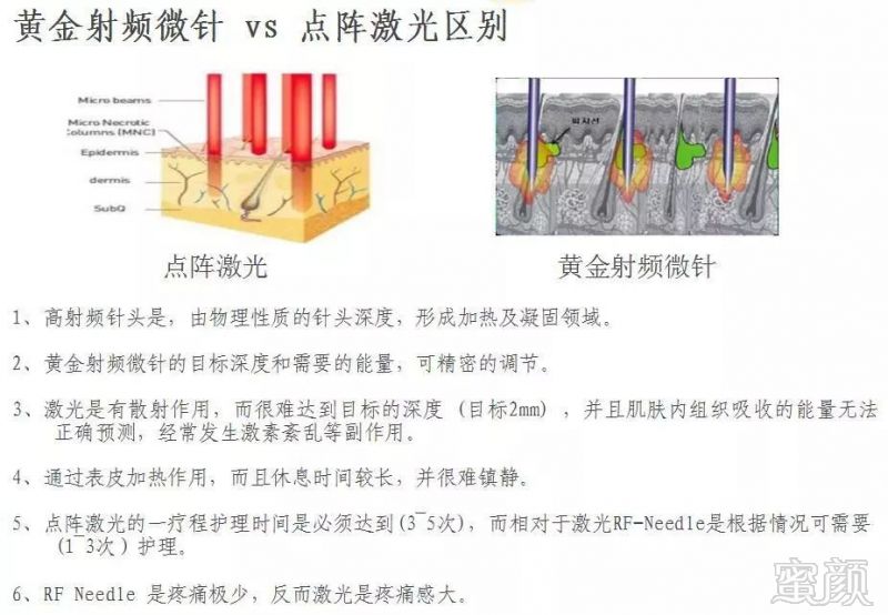 https://img.miyanlife.com/mnt/timg/180611/113K15S3-9.jpg