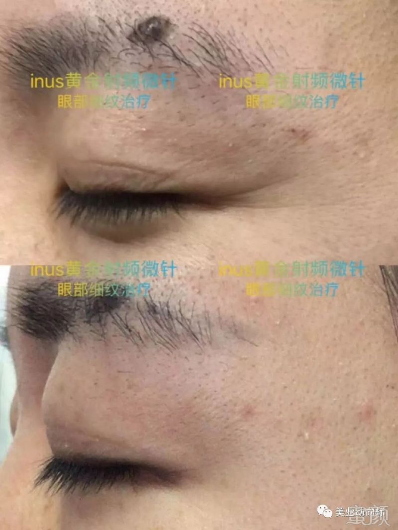 https://img.miyanlife.com/mnt/timg/180611/113K23635-10.jpg