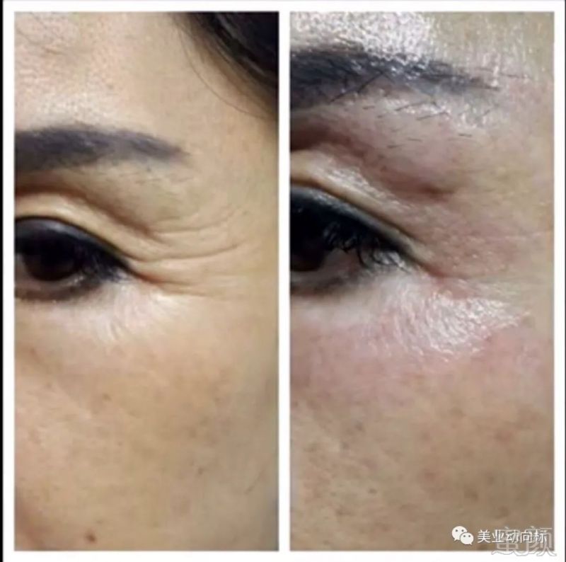 https://img.miyanlife.com/mnt/timg/180611/113K425E-12.jpg