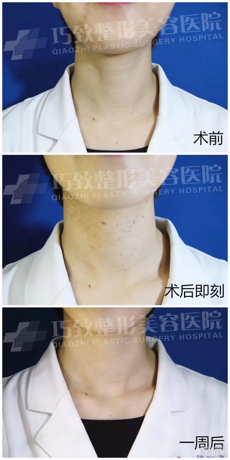https://img.miyanlife.com/mnt/timg/180611/1149525343-2.jpg