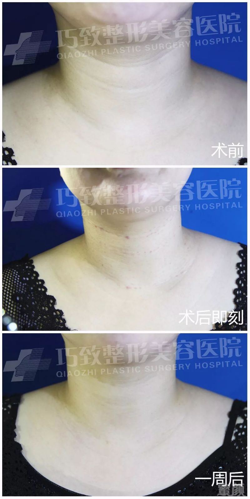 https://img.miyanlife.com/mnt/timg/180611/1149543406-3.jpg