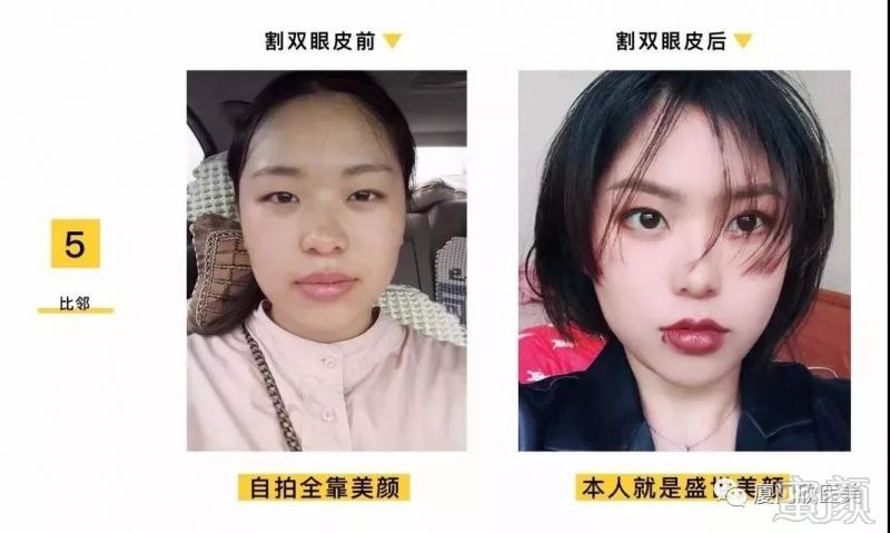 案例图片