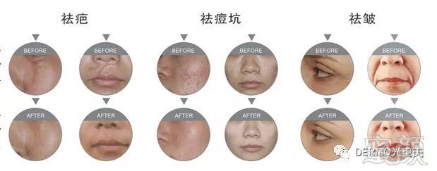 https://img.miyanlife.com/mnt/timg/180611/115KA208-3.jpg