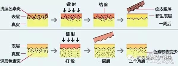 https://img.miyanlife.com/mnt/timg/180611/115R5K47-0.jpg