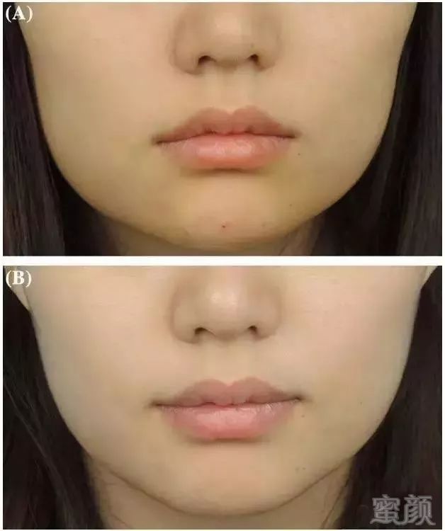 https://img.miyanlife.com/mnt/timg/180611/120035C57-15.jpg