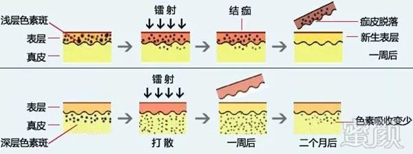 https://img.miyanlife.com/mnt/timg/180611/1216061514-4.jpg