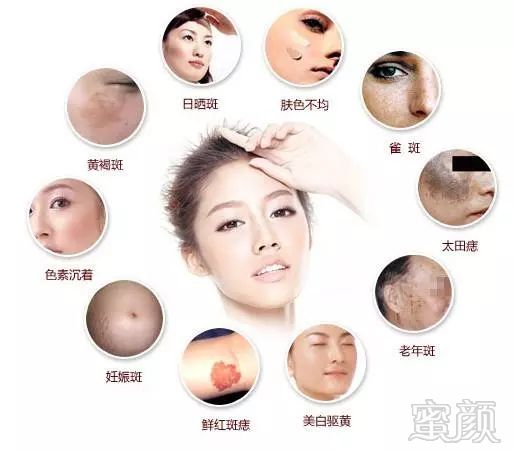https://img.miyanlife.com/mnt/timg/180611/12160640O-0.jpg